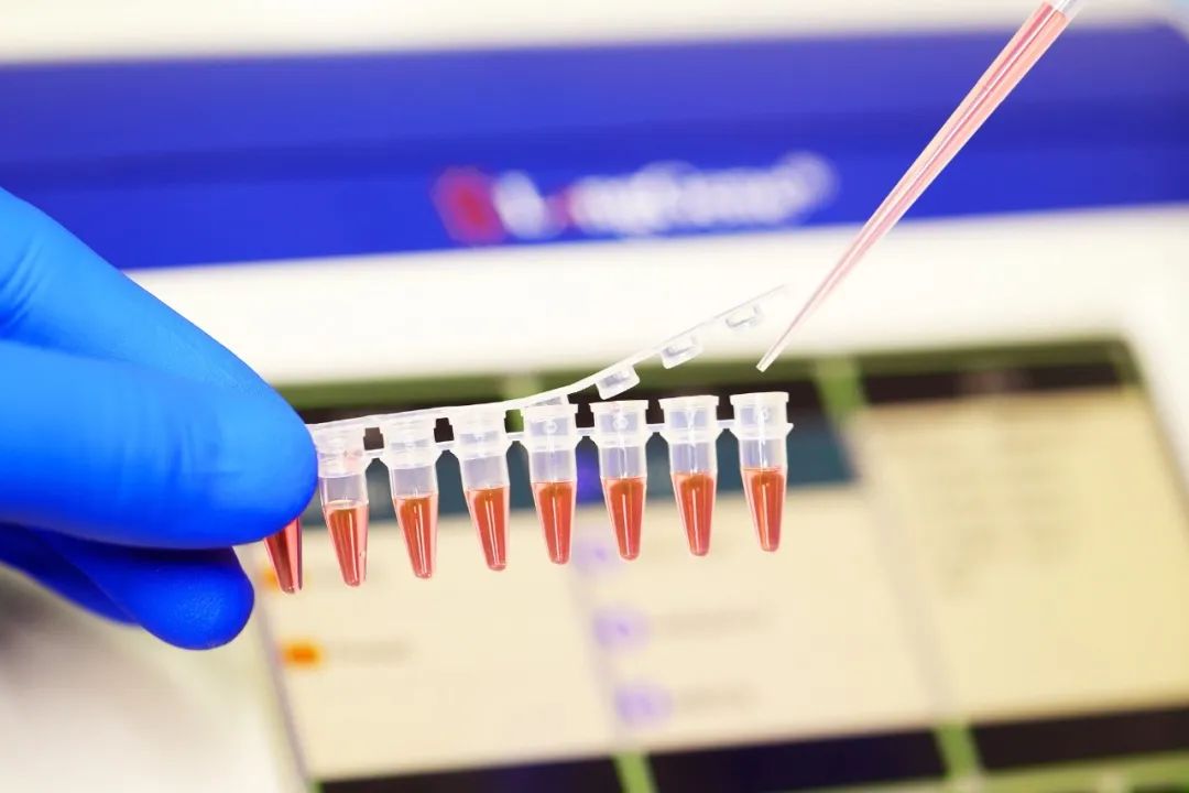 PCR/qPCR ಉಪಭೋಗ್ಯ ವಸ್ತುಗಳನ್ನು ಆಯ್ಕೆ ಮಾಡುವುದು ಹೇಗೆ?